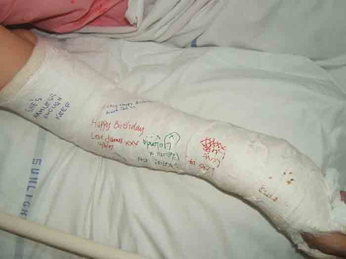 Mum's wrist in plaster